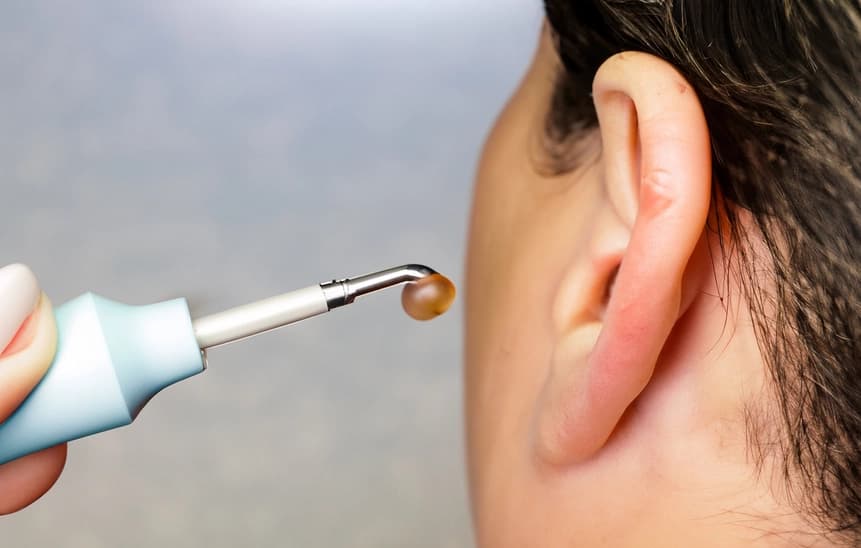 Microsuction ear wax removal being performed on a client