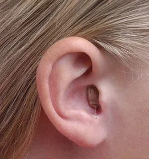 A small in-the-canal hearing aid sitting discreetly inside the ear canal